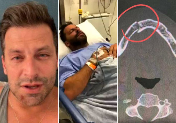 Ator Henri Castelli chora ao denunciar agressão sofrida em Alagoas